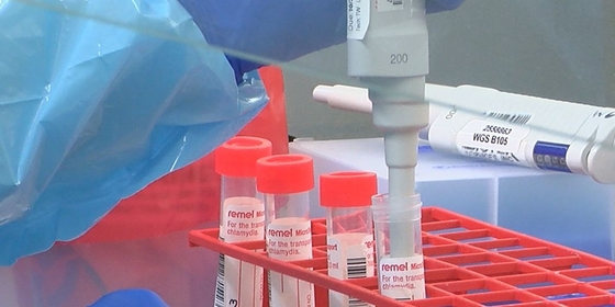 Covid-19 γρήγορη μόνη εξάρτηση δοκιμής αντιγόνων προσδιορισμού για το σπίτι